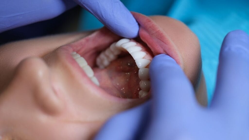 Zirkon diş  nədir? Üstünlükləri və fərqləri zirkonyum dişlər