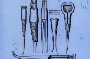 İlk endodontik fayl neçənci ildə ixtira edilib? İlk kanal müalicəsi ilk-endodontik-fayl