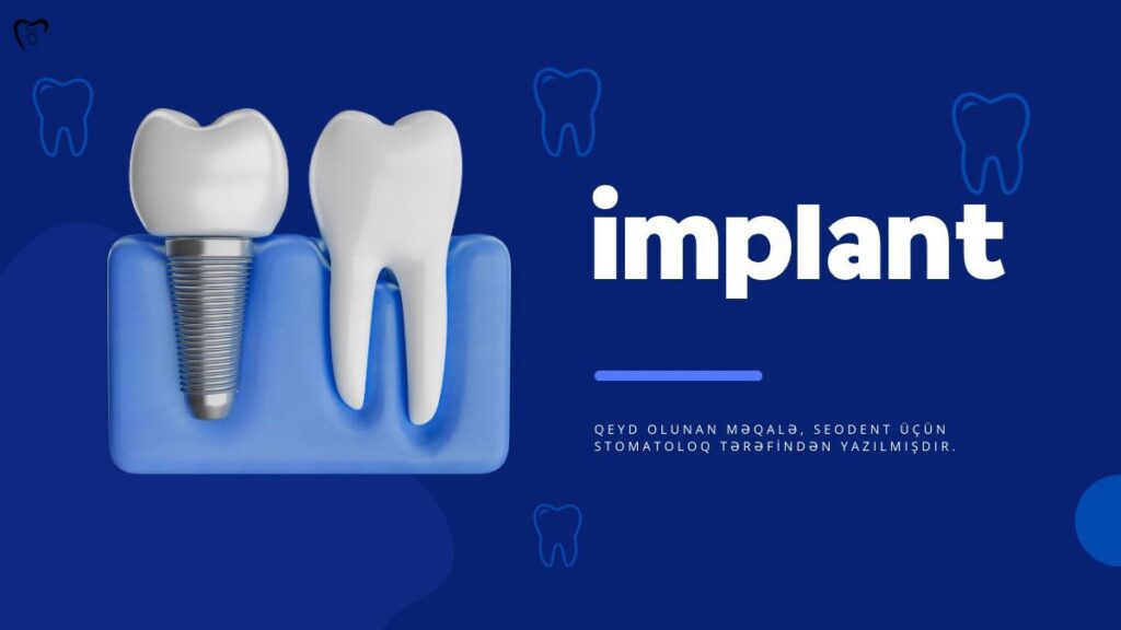 İmplant dişlər və qiymətləri implan-diş