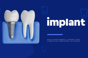 İmplant dişlər və qiymətləri implan-diş